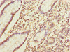 Immunohistochemistry of paraffin-embedded human small intestine tissue using CSB-PA383678ESR1HU at dilution of 1:100