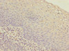 Immunohistochemistry of paraffin-embedded human tonsil tissue using CSB-PA383678ESR1HU at dilution of 1:100