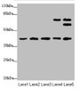 Western blot<br />
 All lanes: IKBIPantibody at 4.49µg/ml<br />
 Lane 1: Mouse kidney tissue<br />
 Lane 2: Mouse lung tissue<br />
 Lane 3: Mouse spleen tissue<br />
 Lane 4: HL60 whole cell lysate<br />
 Lane 5: HepG2 whole cell lysate<br />
 Secondary<br />
 Goat polyclonal to rabbit IgG at 1/10000 dilution<br />
 Predicted band size: 40, 28, 8, 44 kDa<br />
 Observed band size: 40, 67, 63 kDa<br />