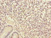Immunohistochemistry of paraffin-embedded human small intestine tissue using CSB-PA383678ESR2HU at dilution of 1:100