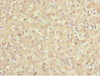 Immunohistochemistry of paraffin-embedded human liver tissue using CSB-PA883433ESR1HU at dilution of 1:100