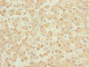 Immunohistochemistry of paraffin-embedded human liver tissue using CSB-PA883433ESR2HU at dilution of 1:100