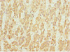 Immunohistochemistry of paraffin-embedded human adrenal gland tissue using CSB-PA621967ESR1HU at dilution of 1:100