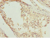 Immunohistochemistry of paraffin-embedded human testis tissue using CSB-PA820920ESR1HU at dilution of 1:100