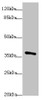 Western blot<br />
 All lanes: POU4F3antibody at 1.97µg/ml + Mouse brain tissue<br />
 Secondary<br />
 Goat polyclonal to rabbit IgG at 1/10000 dilution<br />
 Predicted band size: 37 kDa<br />
 Observed band size: 37 kDa<br />