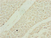 Immunohistochemistry of paraffin-embedded human heart tissue using CSB-PA021277ESR1HU at dilution of 1:100