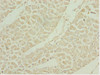 Immunohistochemistry of paraffin-embedded human heart tissue using CSB-PA021277ESR2HU at dilution of 1:100