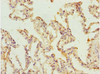 Immunohistochemistry of paraffin-embedded human lung tissue using CSB-PA021277ESR2HU at dilution of 1:100