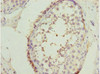 Immunohistochemistry of paraffin-embedded human testis tissue using CSB-PA022987ESR1HU at dilution of 1:100