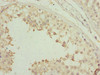 Immunohistochemistry of paraffin-embedded human testis tissue using CSB-PA022987ESR2HU at dilution of 1:100