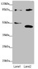 Western blot<br />
 All lanes: TAF5 antibody at 1.74 µg/ml<br />
 Lane 1: Jurkat whole cell lysate<br />
 Lane 2: MCF-7 whole cell lysate<br />
 Secondary<br />
 Goat polyclonal to rabbit IgG at 1/10000 dilution<br />
 Predicted band size: 87, 81 kDa<br />
 Observed band size: 87, 40, 51 kDa<br />