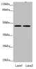 Western blot<br />
 All lanes: ZDHHC16 antibody at 0.89 µg/ml<br />
 Lane 1: MCF-7 whole cell lysate<br />
 Lane 2: HepG2 whole cell lysate<br />
 Secondary<br />
 Goat polyclonal to rabbit IgG at 1/10000 dilution<br />
 Predicted band size: 44, 42, 39, 35 kDa<br />
 Observed band size: 44 kDa<br />