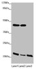 Western blot<br />
 All lanes: ZDHHC16 antibody at 1.91 µg/ml<br />
 Lane 1: MCF-7 whole cell lysate<br />
 Lane 2: HepG2 whole cell lysate<br />
 Lane 3: A375 whole cell lysate<br />
 Secondary<br />
 Goat polyclonal to rabbit IgG at 1/10000 dilution<br />
 Predicted band size: 44, 42, 39, 35 kDa<br />
 Observed band size: 44, 22 kDa<br />