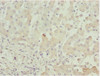 Immunohistochemistry of paraffin-embedded human liver tissue using CSB-PA001380ESR1HU at dilution of 1:100