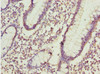 Immunohistochemistry of paraffin-embedded human small intestine tissue using CSB-PA001380ESR2HU at dilution of 1:100