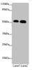 Western blot<br />
 All lanes: ATMIN antibody at 1.53µg/ml<br />
 Lane 1: Hela whole cell lysate<br />
 Lane 2: HepG2 whole cell lysate<br />
 Secondary<br />
 Goat polyclonal to rabbit IgG at 1/10000 dilution<br />
 Predicted band size: 89, 73 kDa<br />
 Observed band size: 89, 51 kDa<br />