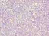 Immunohistochemistry of paraffin-embedded human thymus tissue using CSB-PA872507ESR1HU at dilution of 1:100