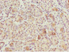 Immunohistochemistry of paraffin-embedded human pancreatic tissue using CSB-PA623663ESR1HU at dilution of 1:100