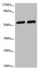 Western blot<br />
 All lanes: CALCOCO2 antibody at 3.36µg/ml<br />
 Lane 1: Hela whole cell lysate<br />
 Lane 2: Raji whole cell lysate<br />
 Secondary<br />
 Goat polyclonal to rabbit IgG at 1/10000 dilution<br />
 Predicted band size: 53, 48, 55, 56, 44 kDa<br />
 Observed band size: 56 kDa<br />