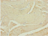 Immunohistochemistry of paraffin-embedded human skeletal muscle tissue using CSB-PA614394ESR1HU at dilution of 1:100