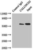 Immunoprecipitating CALCOCO2 in Hela whole cell lysate<br />
 Lane 1: Rabbit control IgG instead of (1µg) instead of CSB-PA614394ESR1HU in Hela whole cell lysate.
 For western blotting, a HRP-conjugated anti-rabbit IgG, specific to the non-reduced form of IgG was used as the Secondary antibody (1/50000) <br />
 Lane 2: CSB-PA614394ESR1HU (4µg) + Hela whole cell lysate (500µg) <br />
 Lane 3: Hela whole cell lysate (20µg) <br />