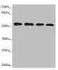 Western blot<br />
 All lanes: CALCOCO2 antibody at 3.66µg/ml<br />
 Lane 1: Hela whole cell lysate<br />
 Lane 2: Jurkat whole cell lysate<br />
 Lane 3: 293T whole cell lysate<br />
 Lane 4: Raji whole cell lysate<br />
 Secondary<br />
 Goat polyclonal to rabbit IgG at 1/10000 dilution<br />
 Predicted band size: 53, 48, 55, 56, 44 kDa<br />
 Observed band size: 56 kDa<br />