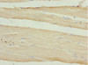 Immunohistochemistry of paraffin-embedded human skeletal muscle tissue using CSB-PA614394ESR2HU at dilution of 1:100