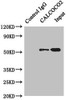 Immunoprecipitating CALCOCO2 in Hela whole cell lysate<br />
 Lane 1: Rabbit control IgG instead of (1µg) instead of CSB-PA614394ESR2HU in Hela whole cell lysate.
 For western blotting, a HRP-conjugated anti-rabbit IgG, specific to the non-reduced form of IgG was uses the Secondary antibody (1/50000) <br />
 Lane 2: CSB-PA614394ESR2HU (4µg) + Hela whole cell lysate (500µg) <br />
 Lane 3: Hela whole cell lysate (20µg) <br />