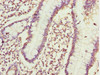 Immunohistochemistry of paraffin-embedded human small intestine tissue using CSB-PA005423ESR1HU at dilution of 1:100