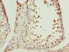 Immunohistochemistry of paraffin-embedded human testis tissue using CSB-PA005423ESR1HU at dilution of 1:100