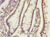 Immunohistochemistry of paraffin-embedded human small intestine tissue using CSB-PA005423ESR2HU at dilution of 1:100