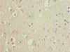 Immunohistochemistry of paraffin-embedded human brain tissue using CSB-PA874802ESR1HU at dilution of 1:100
