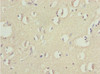 Immunohistochemistry of paraffin-embedded human brain tissue using CSB-PA874802ESR2HU at dilution of 1:100