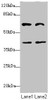 Western blot<br />
 All lanes: DCP1A antibody at 3.79µg/ml<br />
 Lane 1: Jurkat whole cell lysate<br />
 Lane 2: HepG2 whole cell lysate<br />
 Secondary<br />
 Goat polyclonal to rabbit IgG at 1/10000 dilution<br />
 Predicted band size: 64, 60 kDa<br />
 Observed band size: 64, 40 kDa<br />