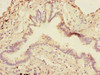 Immunohistochemistry of paraffin-embedded human lung tissue using CSB-PA885684ESR1HU at dilution of 1:100
