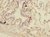 Immunohistochemistry of paraffin-embedded human lung tissue using CSB-PA885684ESR2HU at dilution of 1:100