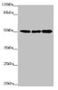Western blot<br />
 All lanes: EEF1A2 antibody at 2.23µg/ml<br />
 Lane 1: MCF-7 whole cell lysate<br />
 Lane 2: Hela whole cell lysate<br />
 Lane 3: Raji whole cell lysate<br />
 Secondary<br />
 Goat polyclonal to rabbit IgG at 1/10000 dilution<br />
 Predicted band size: 50 kDa<br />
 Observed band size: 50 kDa<br />