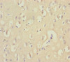 Immunohistochemistry of paraffin-embedded human brain tissue using CSB-PA007412ESR1HU at dilution of 1:100