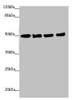 Western blot<br />
 All lanes: EEF1A2 antibody at 1.46µg/ml<br />
 Lane 1: MCF-7 whole cell lysate<br />
 Lane 2: Hela whole cell lysate<br />
 Lane 3: Raji whole cell lysate<br />
 Lane 4: A431 whole cell lysate<br />
 Secondary<br />
 Goat polyclonal to rabbit IgG at 1/10000 dilution<br />
 Predicted band size: 50 kDa<br />
 Observed band size: 50 kDa<br />