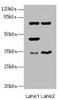 Western blot<br />
 All lanes: EHF antibody at 4.95µg/ml<br />
 Lane 1: Mouse brain tissue<br />
 Lane 2: Mouse lung tissue<br />
 Secondary<br />
 Goat polyclonal to rabbit IgG at 1/10000 dilution<br />
 Predicted band size: 35, 33, 38 kDa<br />
 Observed band size: 35, 45, 63 kDa<br />