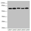 Western blot<br />
 All lanes: ELF2 antibody at 2.27µg/ml<br />
 Lane 1: HL60 whole cell lysate<br />
 Lane 2: A549 whole cell lysate<br />
 Lane 3: MCF-7 whole cell lysate<br />
 Lane 4: Jurkat whole cell lysate<br />
 Lane 5: Hela whole cell lysate<br />
 Secondary<br />
 Goat polyclonal to rabbit IgG at 1/10000 dilution<br />
 Predicted band size: 64, 63, 57, 58, 55 kDa<br />
 Observed band size: 64, 50 kDa<br />