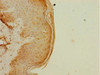 Immunohistochemistry of paraffin-embedded human skin tissue using CSB-PA618015DSR2HU at dilution of 1:100