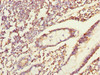 Immunohistochemistry of paraffin-embedded human small intestine tissue using CSB-PA846631ESR2HU at dilution of 1:100