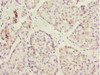 Immunohistochemistry of paraffin-embedded human pancreatic tissue using CSB-PA846631ESR2HU at dilution of 1:100