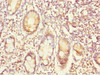 Immunohistochemistry of paraffin-embedded human small intestine tissue using CSB-PA860766DSR1HU at dilution of 1:100