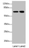 Western blot<br />
 All lanes: EYA3 antibody at 2.88µg/ml<br />
 Lane 1: Hela whole cell lysate<br />
 Lane 2: 293T whole cell lysate<br />
 Secondary<br />
 Goat polyclonal to rabbit IgG at 1/10000 dilution<br />
 Predicted band size: 63, 49, 59, 57, 58 kDa<br />
 Observed band size: 63, 67 kDa<br />