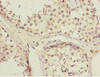 Immunohistochemistry of paraffin-embedded human testis tissue using CSB-PA818775ESR1HU at dilution of 1:100