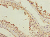 Immunohistochemistry of paraffin-embedded human testis tissue using CSB-PA818775ESR2HU at dilution of 1:100