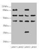 Western blot<br />
 All lanes: FLVCR2 antibody at 0.89µg/ml<br />
 Lane 1: MCF-7 whole cell lysate<br />
 Lane 2: A549 whole cell lysate<br />
 Lane 3: Mouse lung tissue<br />
 Lane 4: Mouse liver tissue<br />
 Secondary<br />
 Goat polyclonal to rabbit IgG at 1/10000 dilution<br />
 Predicted band size: 58, 36 kDa<br />
 Observed band size: 58, 86, 45, 26 kDa<br />