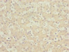 Immunohistochemistry of paraffin-embedded human liver tissue using CSB-PA861986DSR1HU at dilution of 1:100